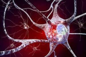 What is Lewy Body Dementia: A Complex Brain Disorder